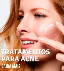 Link Relacionado - Tratamentos por Assunto - Acne - Estética Modelle