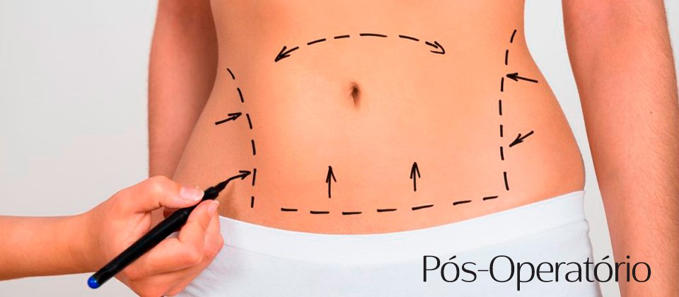 Tratamentos por Assunto Pós-Operatório  Estética Modelle